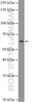 FBXW5 Antibody in Western Blot (WB)