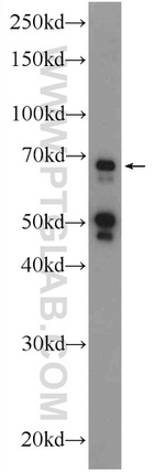 FBXW5 Antibody in Western Blot (WB)