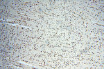 MAD1 Antibody in Immunohistochemistry (Paraffin) (IHC (P))