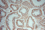 DEAF1 Antibody in Immunohistochemistry (Paraffin) (IHC (P))