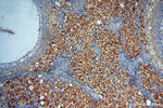 SSH3 Antibody in Immunohistochemistry (Paraffin) (IHC (P))
