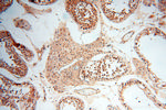 SSH3 Antibody in Immunohistochemistry (Paraffin) (IHC (P))
