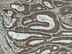 SSH3 Antibody in Immunohistochemistry (Paraffin) (IHC (P))
