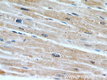 PHD3 Antibody in Immunohistochemistry (Paraffin) (IHC (P))