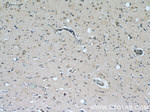 PHD3 Antibody in Immunohistochemistry (Paraffin) (IHC (P))