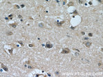 PHD3 Antibody in Immunohistochemistry (Paraffin) (IHC (P))
