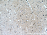 PHD3 Antibody in Immunohistochemistry (Paraffin) (IHC (P))