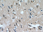 PHD3 Antibody in Immunohistochemistry (Paraffin) (IHC (P))