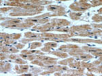 PHD3 Antibody in Immunohistochemistry (Paraffin) (IHC (P))