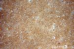 PHD3 Antibody in Immunohistochemistry (Paraffin) (IHC (P))