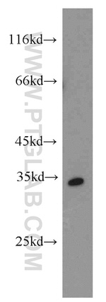 PHD3 Antibody in Western Blot (WB)
