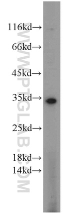 PHD3 Antibody in Western Blot (WB)