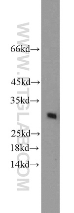 PHD3 Antibody in Western Blot (WB)
