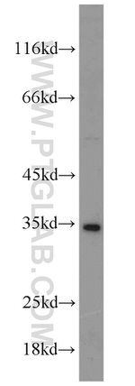 PHD3 Antibody in Western Blot (WB)