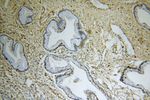 TBC1D22A Antibody in Immunohistochemistry (Paraffin) (IHC (P))