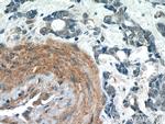 TBC1D22A Antibody in Immunohistochemistry (Paraffin) (IHC (P))