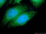 PIGS Antibody in Immunocytochemistry (ICC/IF)