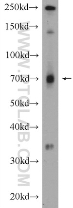 PIGS Antibody in Western Blot (WB)