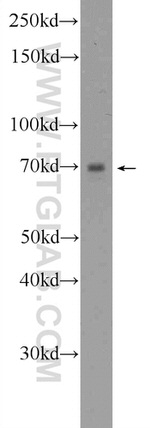 PIGS Antibody in Western Blot (WB)