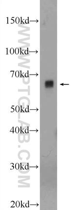 PIGS Antibody in Western Blot (WB)
