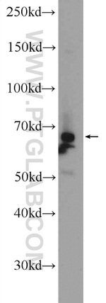 PIGS Antibody in Western Blot (WB)