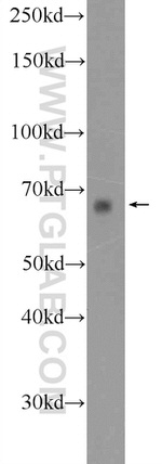 PIGS Antibody in Western Blot (WB)