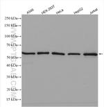 LSM14A Antibody in Western Blot (WB)