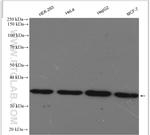 MRPL15 Antibody in Western Blot (WB)