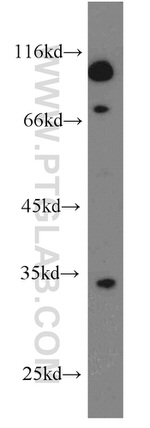 MRPL15 Antibody in Western Blot (WB)