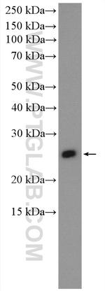 IGLV6-57 Antibody in Western Blot (WB)
