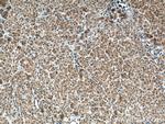 MRPS23 Antibody in Immunohistochemistry (Paraffin) (IHC (P))