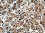 MRPS23 Antibody in Immunohistochemistry (Paraffin) (IHC (P))