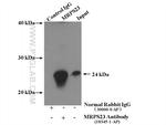 MRPS23 Antibody in Immunoprecipitation (IP)