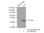 p35 Antibody in Immunoprecipitation (IP)