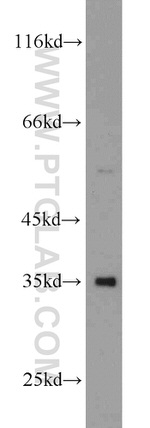 p35 Antibody in Western Blot (WB)
