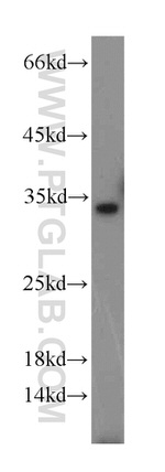 p35 Antibody in Western Blot (WB)