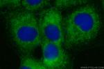 MKRN3 Antibody in Immunocytochemistry (ICC/IF)