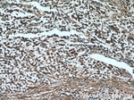 DTX1 Antibody in Immunohistochemistry (Paraffin) (IHC (P))