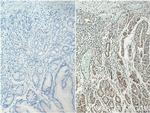 HNRNPL Antibody in Immunohistochemistry (Paraffin) (IHC (P))