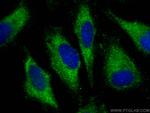 PLD1 Antibody in Immunocytochemistry (ICC/IF)