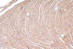 PLD1 Antibody in Immunohistochemistry (Paraffin) (IHC (P))