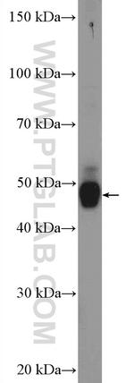 Orexin receptor 1 Antibody in Western Blot (WB)
