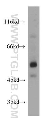 Orexin receptor 1 Antibody in Western Blot (WB)