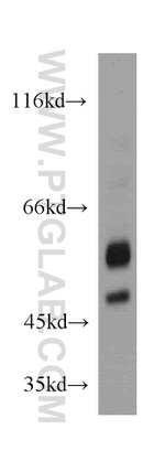Orexin receptor 1 Antibody in Western Blot (WB)