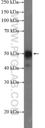 Orexin receptor 1 Antibody in Western Blot (WB)