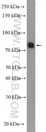SPATA20 Antibody in Western Blot (WB)