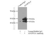ANGPTL4 Antibody in Immunoprecipitation (IP)