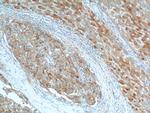 KISS1 Antibody in Immunohistochemistry (Paraffin) (IHC (P))