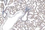 SLC6A14 Antibody in Immunohistochemistry (Paraffin) (IHC (P))