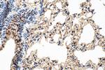 SLC6A14 Antibody in Immunohistochemistry (Paraffin) (IHC (P))